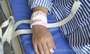 普外科健康教育篇：预防导管滑脱11招