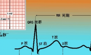 ECG各波段正常值范围