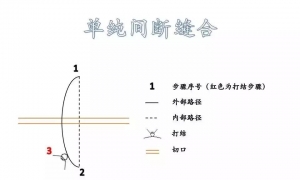 图解|常用外科缝合路径示意图