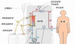 肾内科护士必须掌握的五大问题