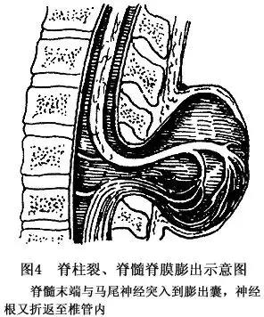 高！一个汽车轮胎，完美解决手术卧位难题