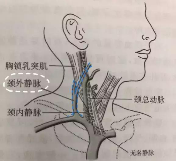 怕！这个部位的留置针，决不能久留！