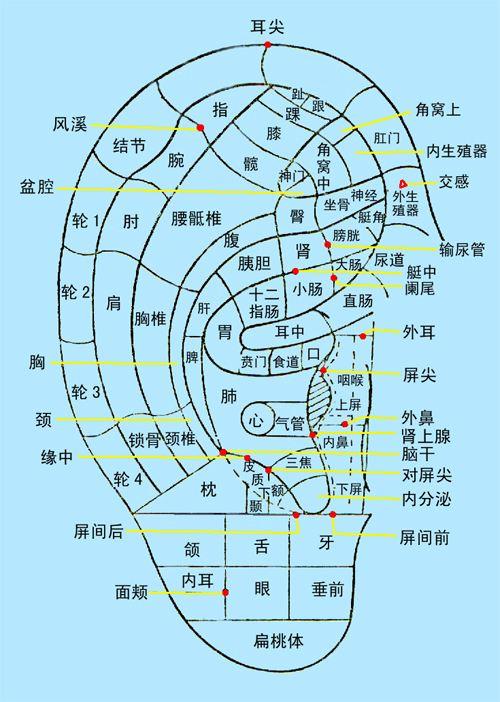 耳穴埋籽法