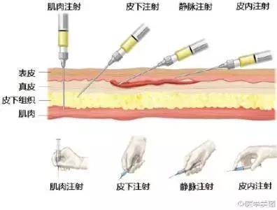 让护士爱恨交加的低分子肝素