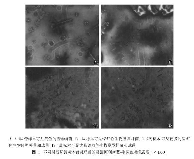 间歇性导尿重复插管易感染？常规认识可能是错的！