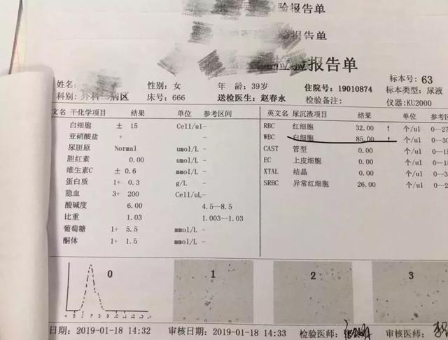 这种情况下，导管应不应该拔？