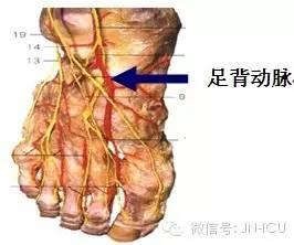 手把手教会护士，正确的动脉采血（部位、方法）