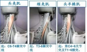 精美3D骨骼肌解剖图谱（珍贵资料）