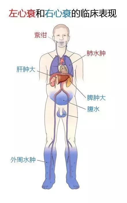 史上最全的心血管疾病图文详解 记得收藏