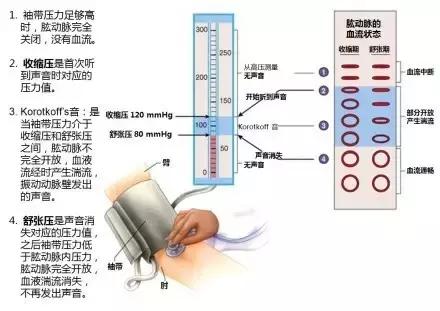 史上最全的心血管疾病图文详解 记得收藏