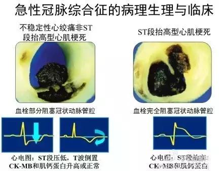 史上最全的心血管疾病图文详解 记得收藏