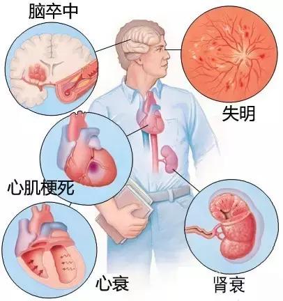 史上最全的心血管疾病图文详解 记得收藏