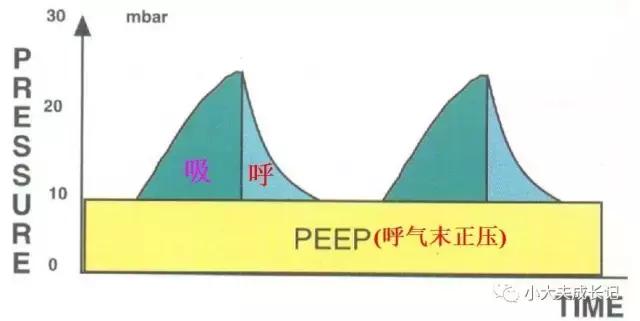 无创呼吸机那些事儿