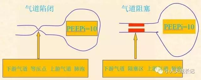 无创呼吸机那些事儿