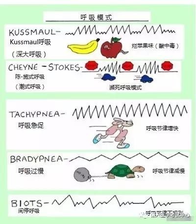 10分钟搞定呼吸系统