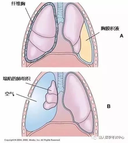 10分钟搞定呼吸系统