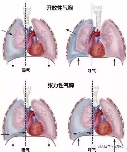 10分钟搞定呼吸系统