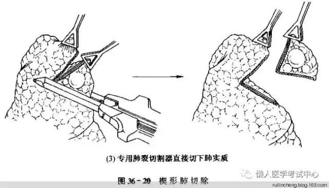 10分钟搞定呼吸系统