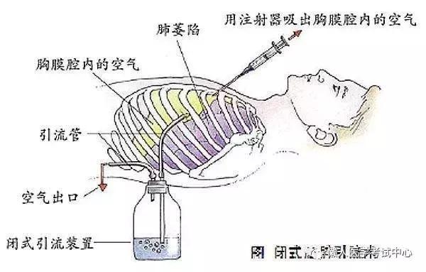 10分钟搞定呼吸系统