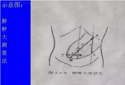 腹部体格检查