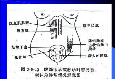 腹部体格检查