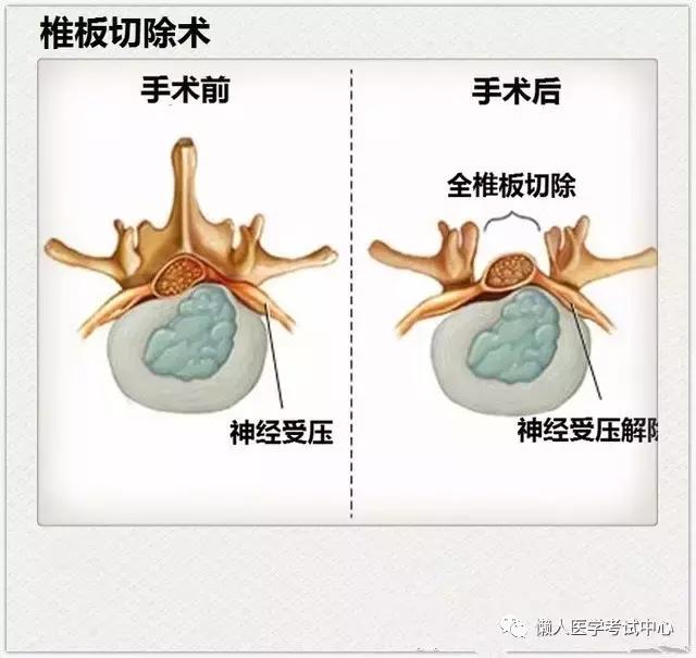 运动系统——10分钟搞定