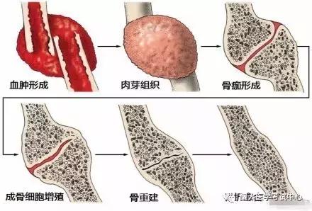 运动系统——10分钟搞定