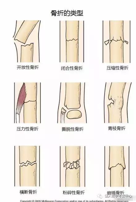 运动系统——10分钟搞定