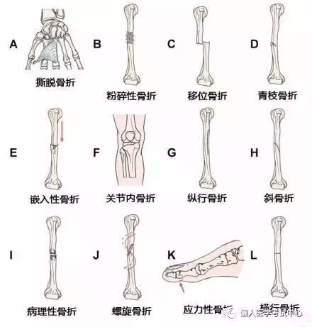 运动系统——10分钟搞定