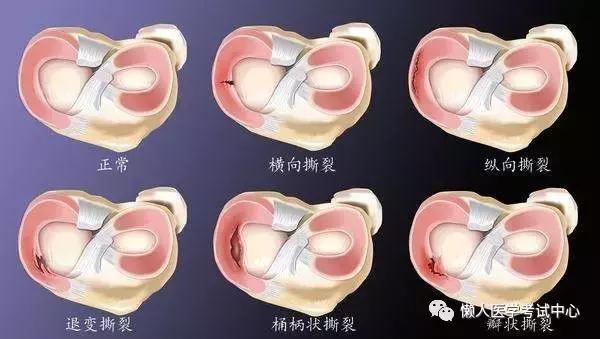 运动系统——10分钟搞定