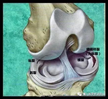 运动系统——10分钟搞定