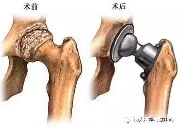 运动系统——10分钟搞定