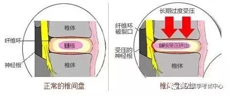 运动系统——10分钟搞定