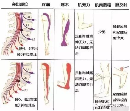 运动系统——10分钟搞定