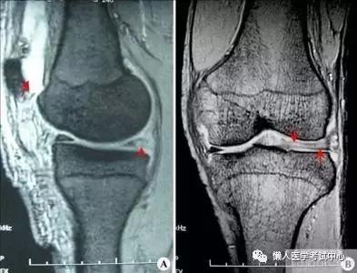 运动系统——10分钟搞定