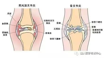 运动系统——10分钟搞定