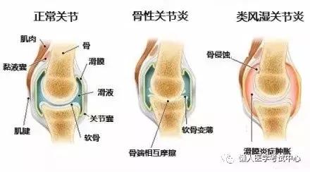 运动系统——10分钟搞定