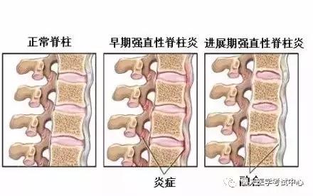 运动系统——10分钟搞定