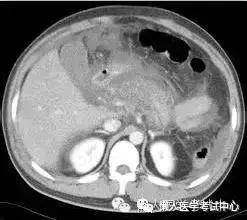 10分钟搞定消化系统