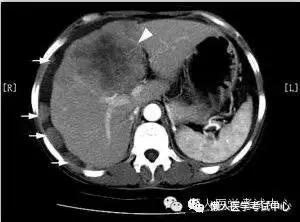 10分钟搞定消化系统