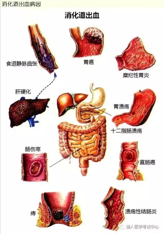 10分钟搞定消化系统