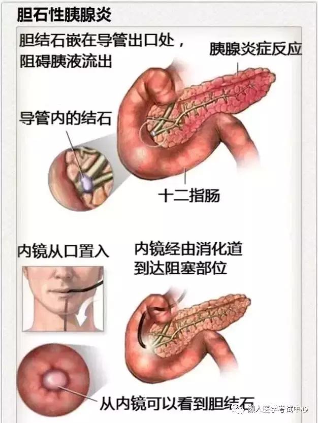 10分钟搞定消化系统