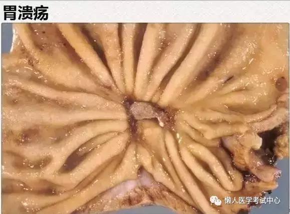 10分钟搞定消化系统