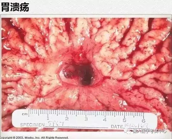 10分钟搞定消化系统