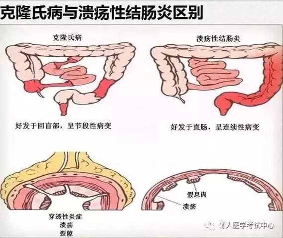 10分钟搞定消化系统