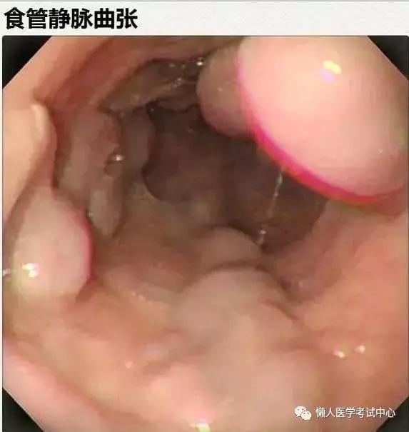 10分钟搞定消化系统