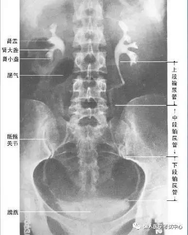 「医学美图」泌尿系统——10分钟搞定