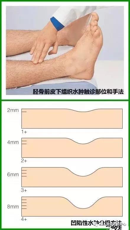 「医学美图」泌尿系统——10分钟搞定