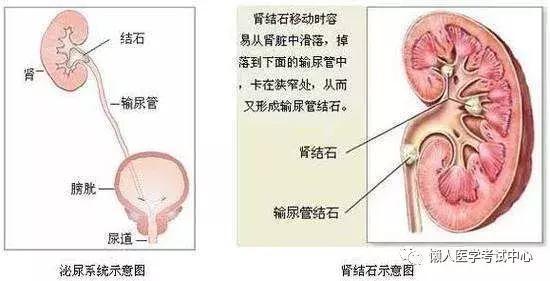 「医学美图」泌尿系统——10分钟搞定