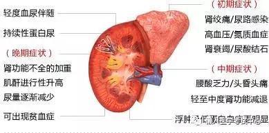 「医学美图」泌尿系统——10分钟搞定